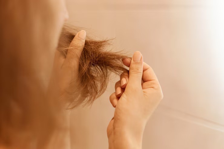 kerusakan rambut karena kunciran, rambut rontok parah, tips rambut sehat berhijab, cara mengikat rambut tanpa merusak, perawatan rambut ibu menyusui, rambut patah karena ikat rambut, rambut rusak karena jilbab, mengatasi rambut rontok setelah melahirkan